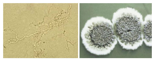 schimmel infectie overzicht